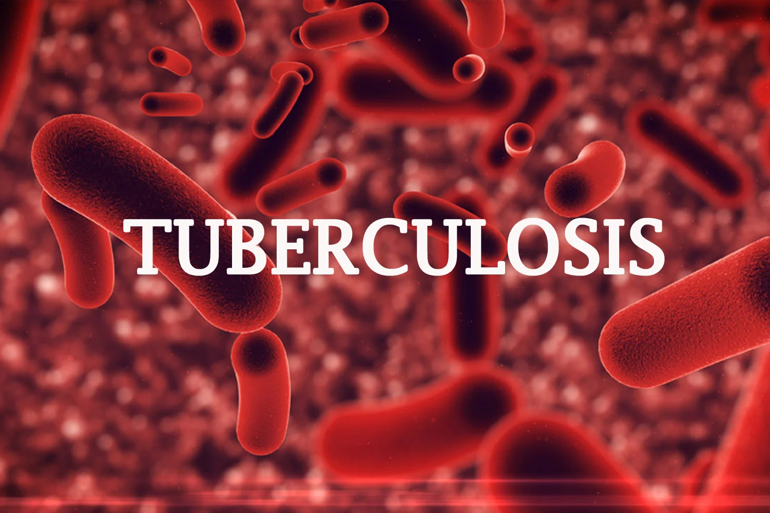 How Funding Gaps, Undetected Cases Threaten Nigeria’s Fight Against Tuberculosis